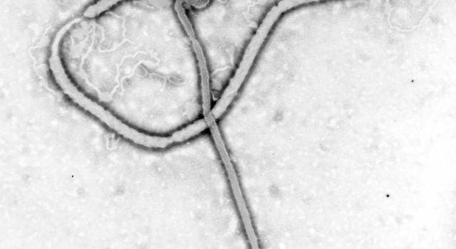 Virus Ebola: un numéro vert pour s’informer