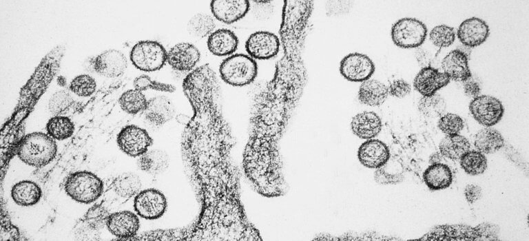 Cristoli: le nouveau virus découvert par une équipe de l’hôpital Mondor de Créteil