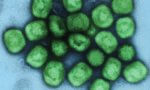678 cas de variole du singe en Ile-de-France