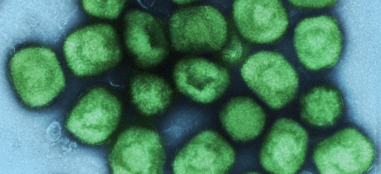 24 cas de variole du singe en Ile-de-France